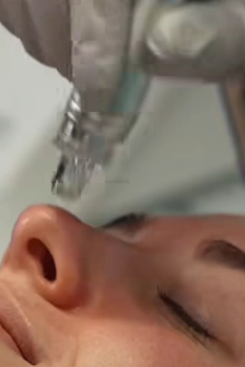 Oxygen infusion facial handpiece near the cheek